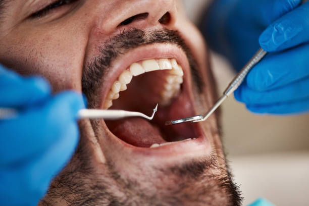 Best Broken or Cracked Tooth Emergency Dentist in Southwest Sandhill, TX